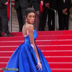 Winnie Harlow, la top model con vitiligo que le dio otro color a las pasarelas