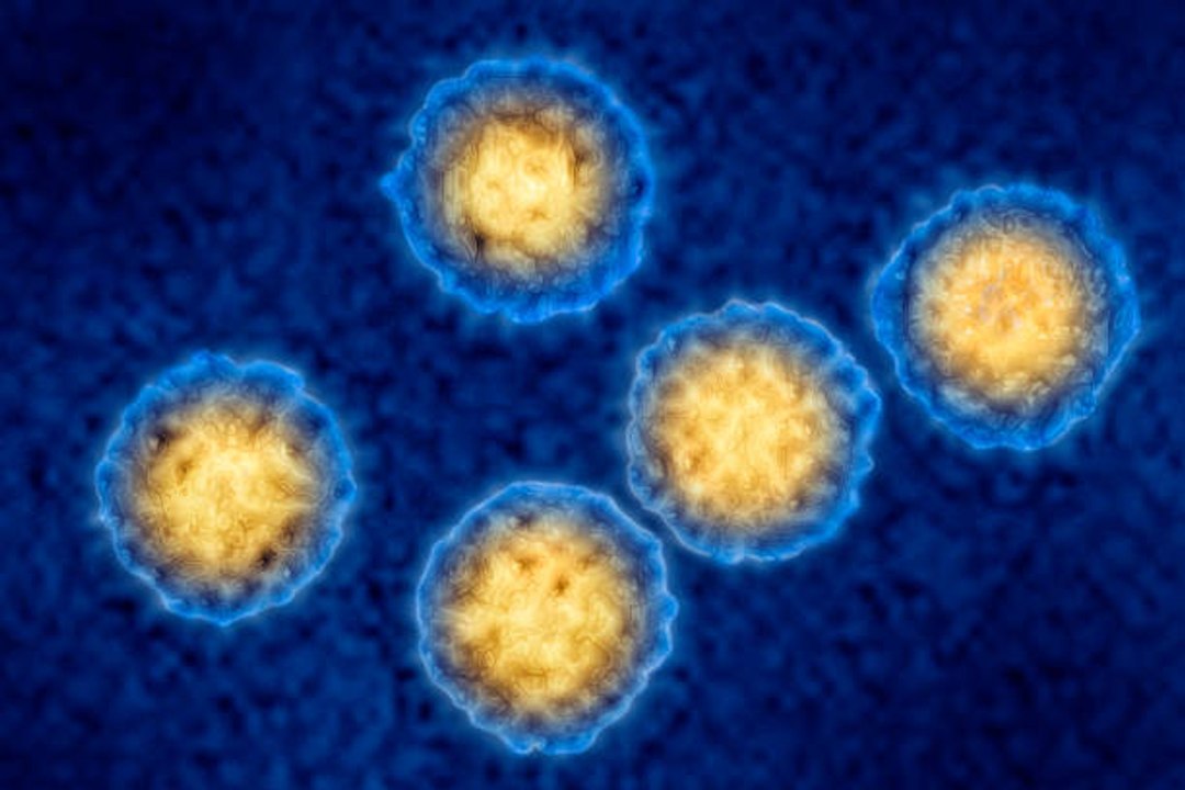Was ist das Cytomegalie-Virus?