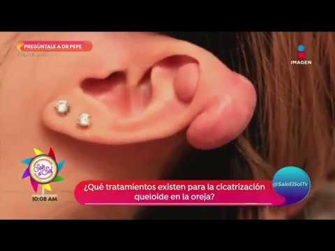Pregúntale al Dr. Pepe Bandera: ¿Qué alimentos ayudan a bajar los niveles de glucosa? | Sale el Sol