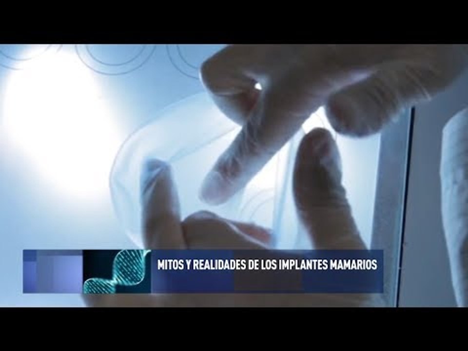 Mitos y realidades de los implantes mamarios