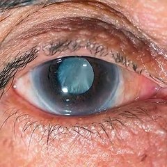 Increibles tips para hacer crecer tus pestañas