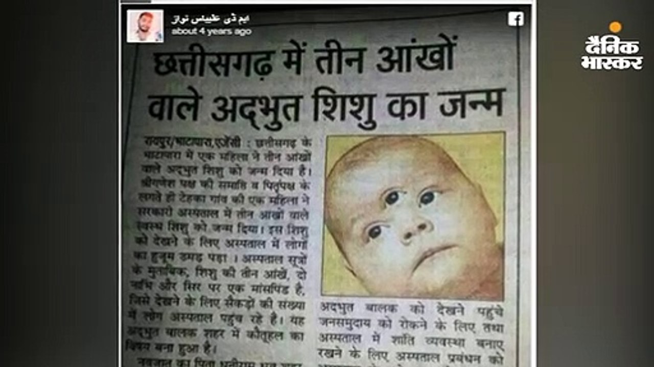 सच्ची थी छत्तीसगढ़ में तीन आंख वाले बच्चे की कहानी