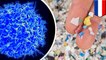 Microplastics cause immune cells to die 3 times faster than normal