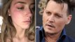 Amber Heard's EXPLOSIVE Domestic Abuse Allegations Against Johnny Depp (FULL REPORT)