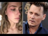 Amber Heard's EXPLOSIVE Domestic Abuse Allegations Against Johnny Depp (FULL REPORT)