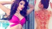 Hottie Urvashi Rautela Undergoes Painful Cupping Therapy | Bollywood News | SpotboyE