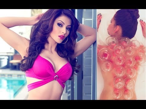 Hottie Urvashi Rautela Undergoes Painful Cupping Therapy | Bollywood News | SpotboyE