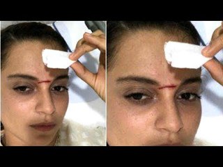 Kangana Ranaut Severely Injured on the sets of Manikarnika, Gets 15 Stitches On Forehead | SpotboyE