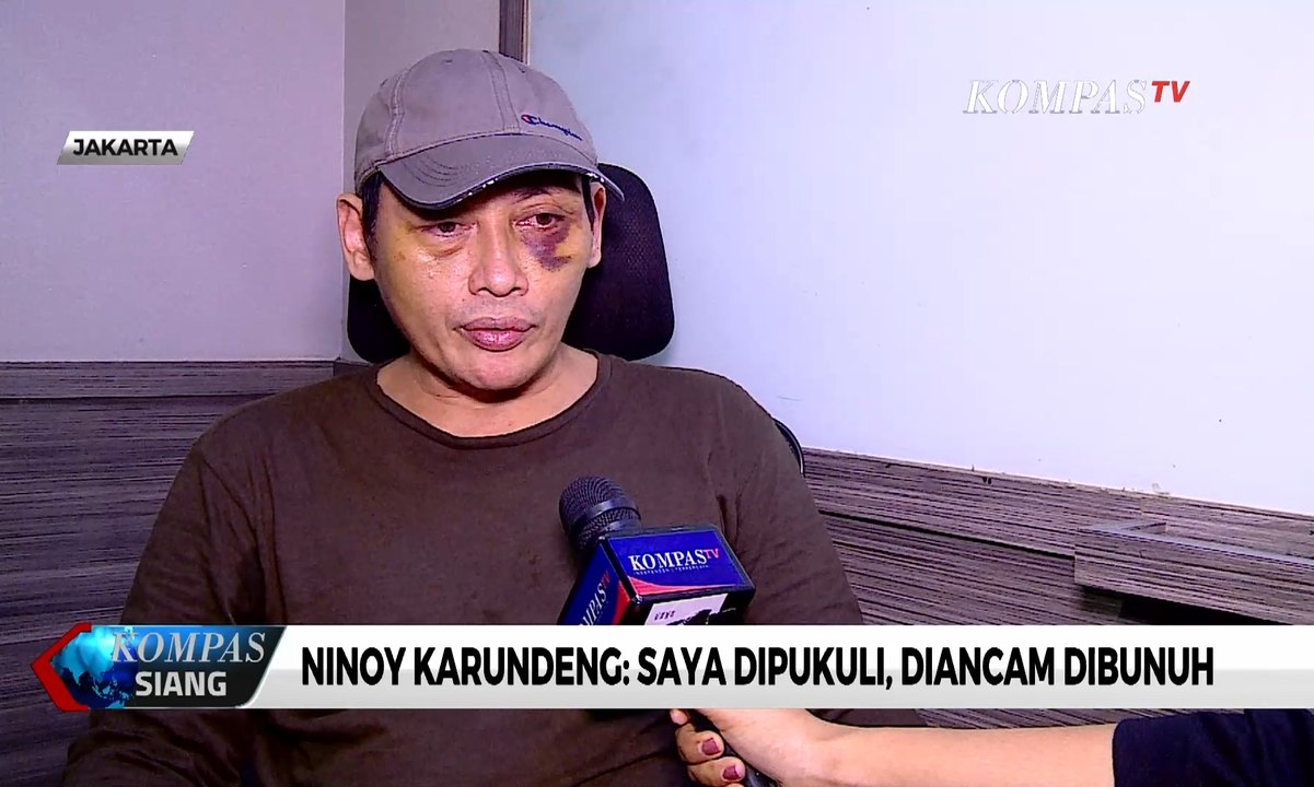 Ninoy Karundeng: Saya Dipukuli, Diancam Dibunuh