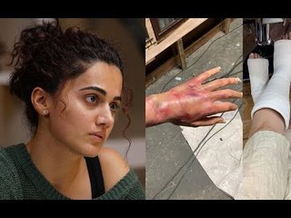 Taapsee Pannu Shares Pics Of Bruised Hand & Fractured Leg ; Fans Get Worried