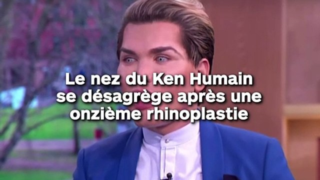 Le nez du Ken Humain se désagrège après une onzième rhinoplastie