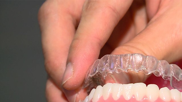 bd-ortodoncia-invisible-091019