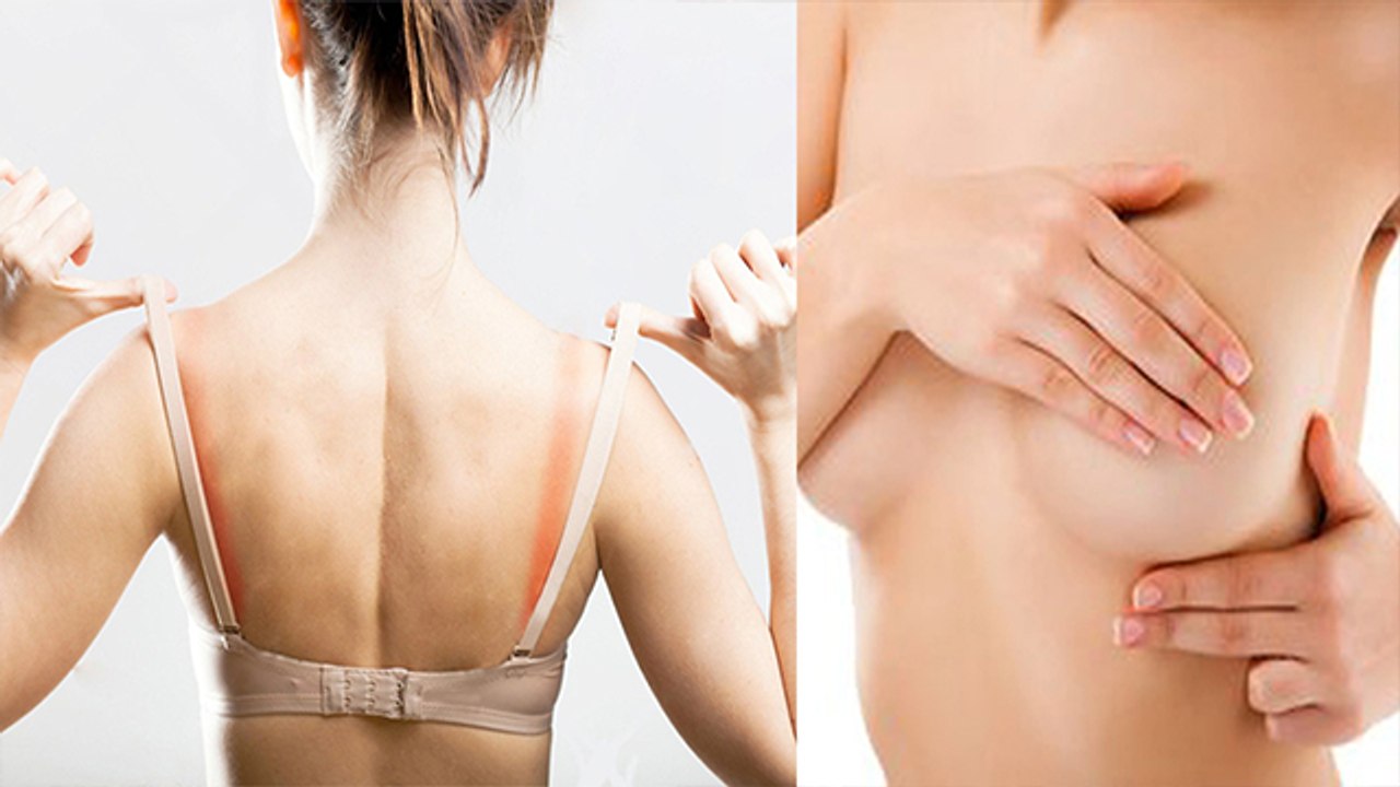 स्तन रैशेस के लिए घरेलू उपचार | Rashes Home Remedies | Boldsky