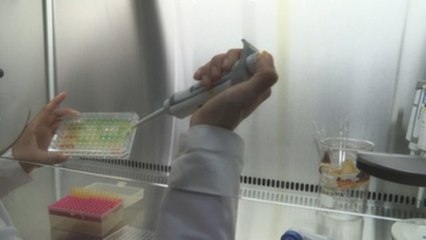 Argentina implanta un tratamiento para el cáncer renal único en Latinoamérica
