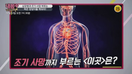 심장병과 조기 사망 부르는 죽은 엉덩이를 깨워라!_내 몸 플러스 166회 예고