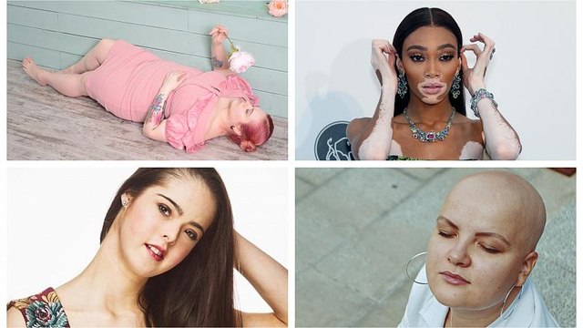 Со мной всё так : что скрывается за бодипозитивом? | #КУБ