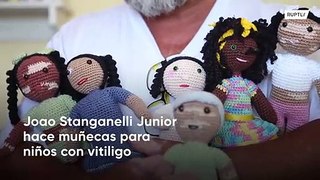 Abuelo tejedor crea muñecas con vitiligo para enseñar a los niños positividad corporal