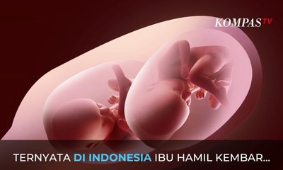Fenomena Sindrom Langka Pada Bayi Kembar, Ini Penjelasan Dokter