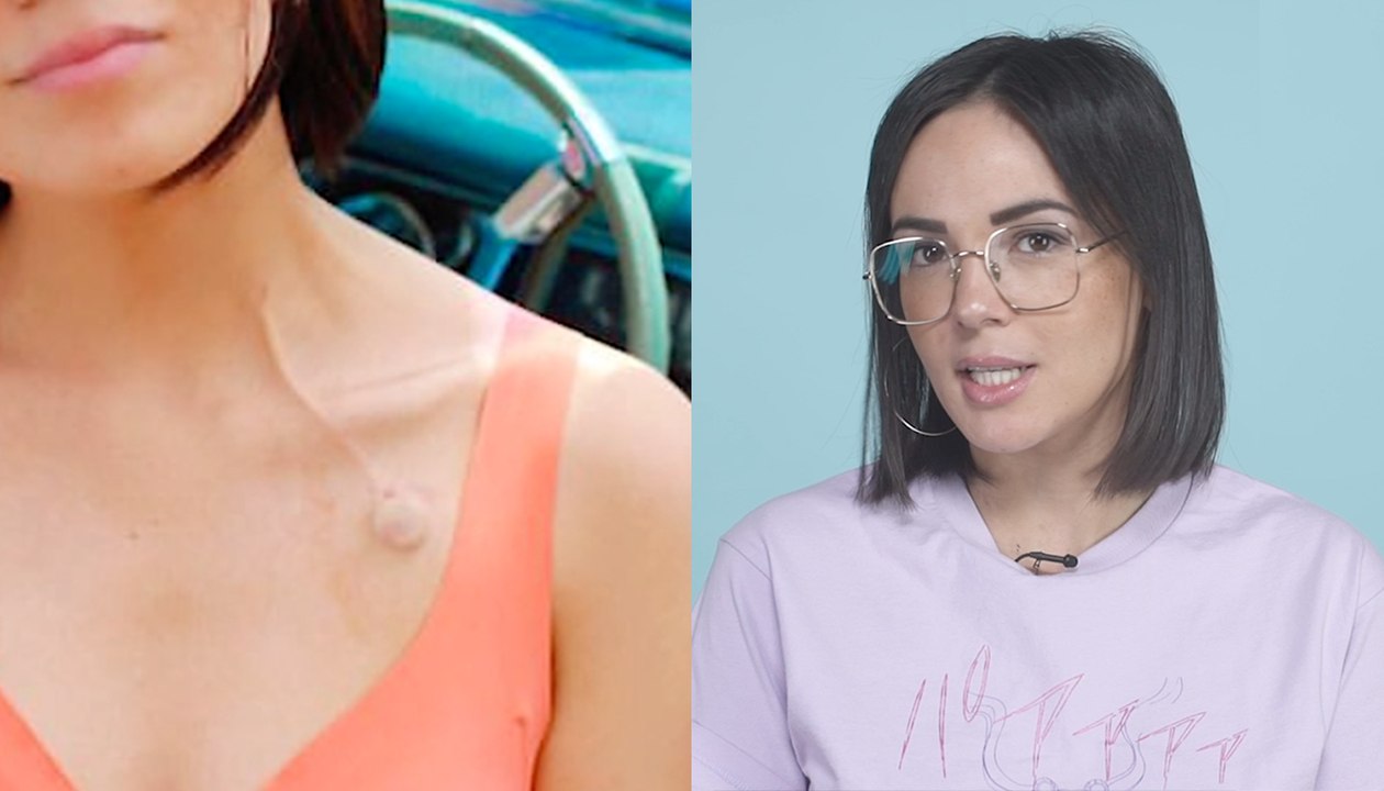 Pourquoi j’ai essayé de cacher mon cancer | Le Speech d’Agathe Auproux