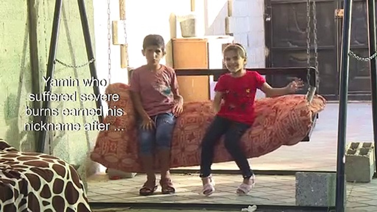 Five years after war, Gaza's little 'Iron Man' stands tall