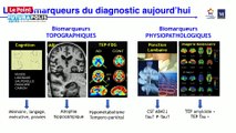 Futurapolis Santé 2019 - Alzheimer, une maladie que l’on finira bien par oublier… mais quand ?