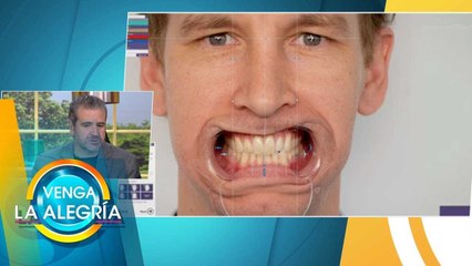 ¡Descubre de qué trata el diseño de sonrisa y renueva la tuya! | Venga La Alegría