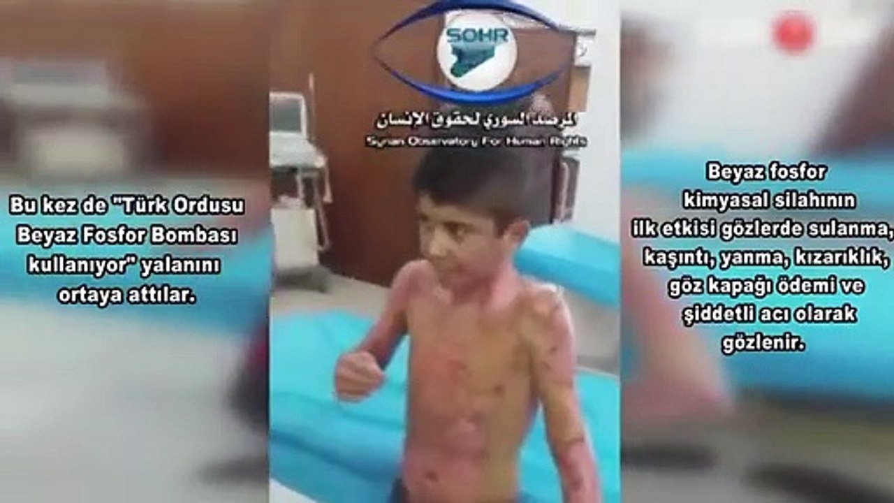 Terör örgütünün "kimyasal silah" yalanı ortaya çıktı