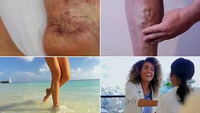 Utah Vein Specialists: Leg Pain in Salt Lake City