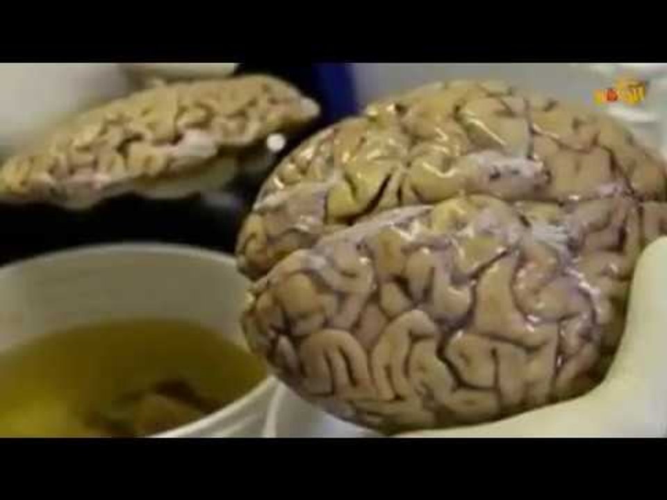 هل سمعت عن بنك الادمغه من قبل شاهد الان