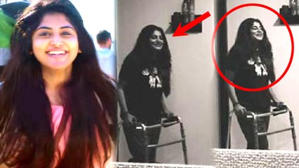 Manjima Mohan recovering after leg surgery