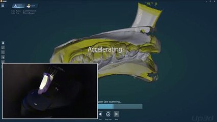 Triple tray dental impression scanning