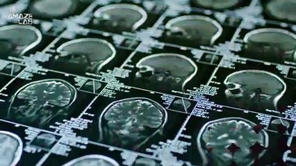 New Ethical Concerns Are Raised About Lab-Grown Mini-Brains