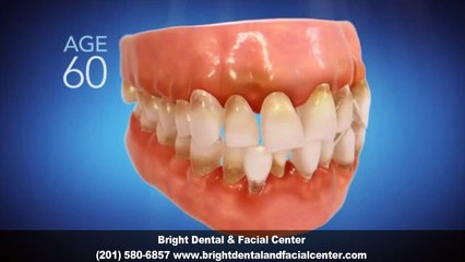 Invisalign Dentist Englewood Cliffs NJ