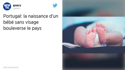 Le petit Roberto naît sans visage, le Portugal est bouleversé
