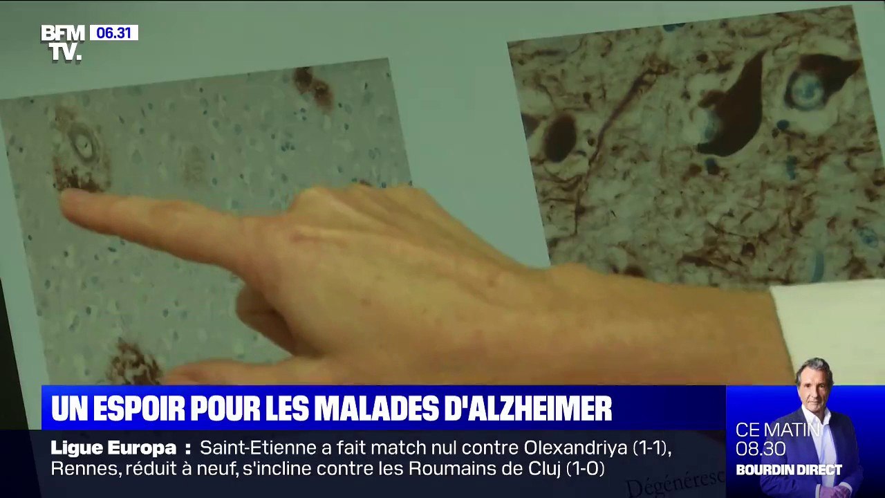 Alzheimer: pour la première fois, un laboratoir...