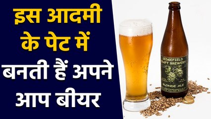 Viral, इस शख्स के Stomach में अपने आप ही बनती है Beer, वजह जानकर नहीं होगा यकीन | वनइंड़िया हिंदी