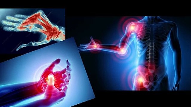 Decrease arthritis pain 2020 ( WINTER IS COMMING ) VIVE