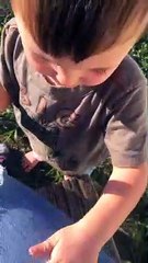 Boy Thinks Leg Looks like Hotdog