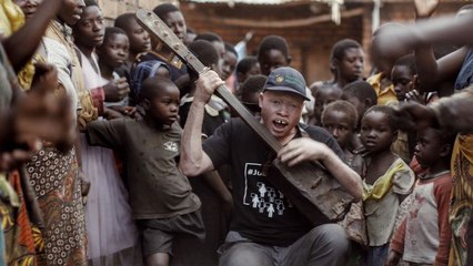A Street Musician Fights the Stigma of Albinism in Africa