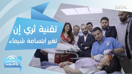 تقنية الجيل الثاني من "ثري إن" تغير شكل ابتسامة شيماء.. بحضور 16 طبيباً!