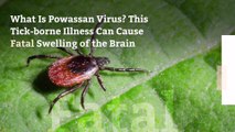What Is Powassan Virus? This Tick-borne Illness Can Cause Fatal Swelling of the Brain
