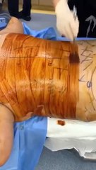 Plastic Surgery Paramus