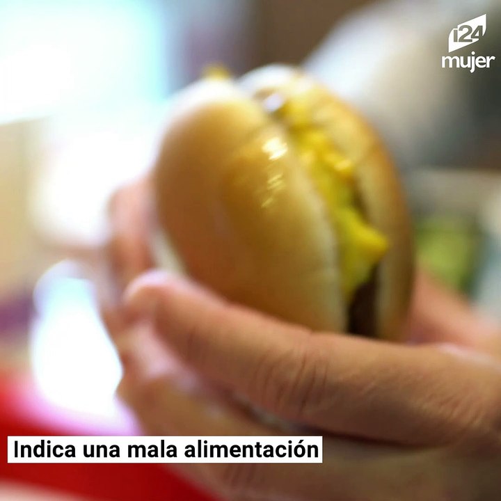 Dime dónde te salen granitos y te diré lo que revela sobre tu salud