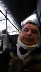 Uçak kazasında yaralanan yolcu