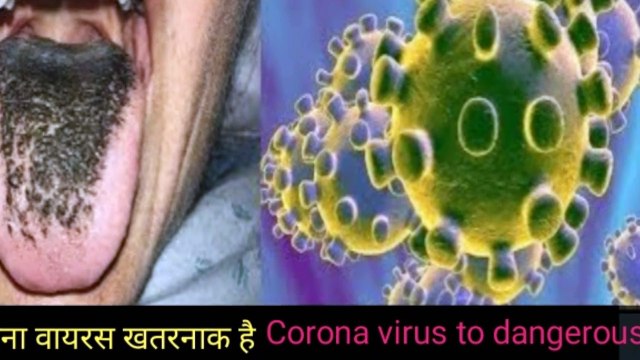 Coronavirus in China, coronavirus, coronavirus in usa, Who, coronavirus India, coronavirus Japan, coronavirus Uk, coronavirus France, coronavirus urop, coronavirus Pakistan, coronavirus Brazil, coronavirus Africa,