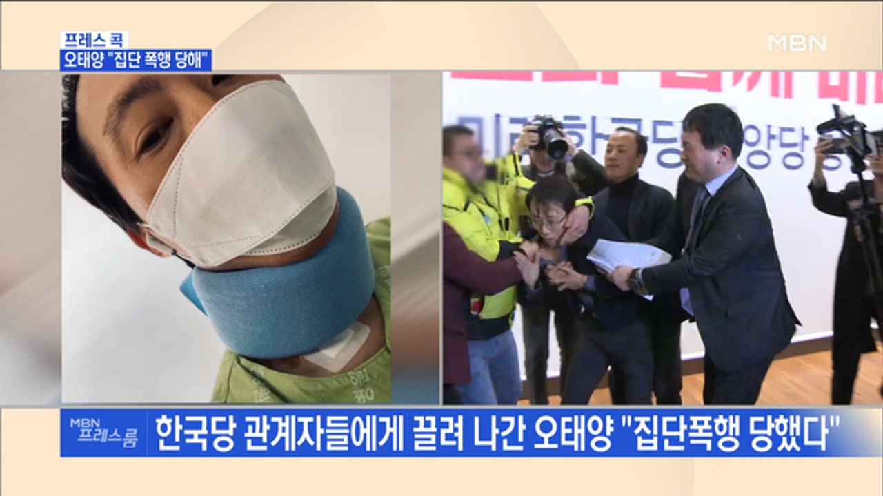 [MBN 프레스룸] 프레스콕 / 오태양 "집단 폭행 당해"