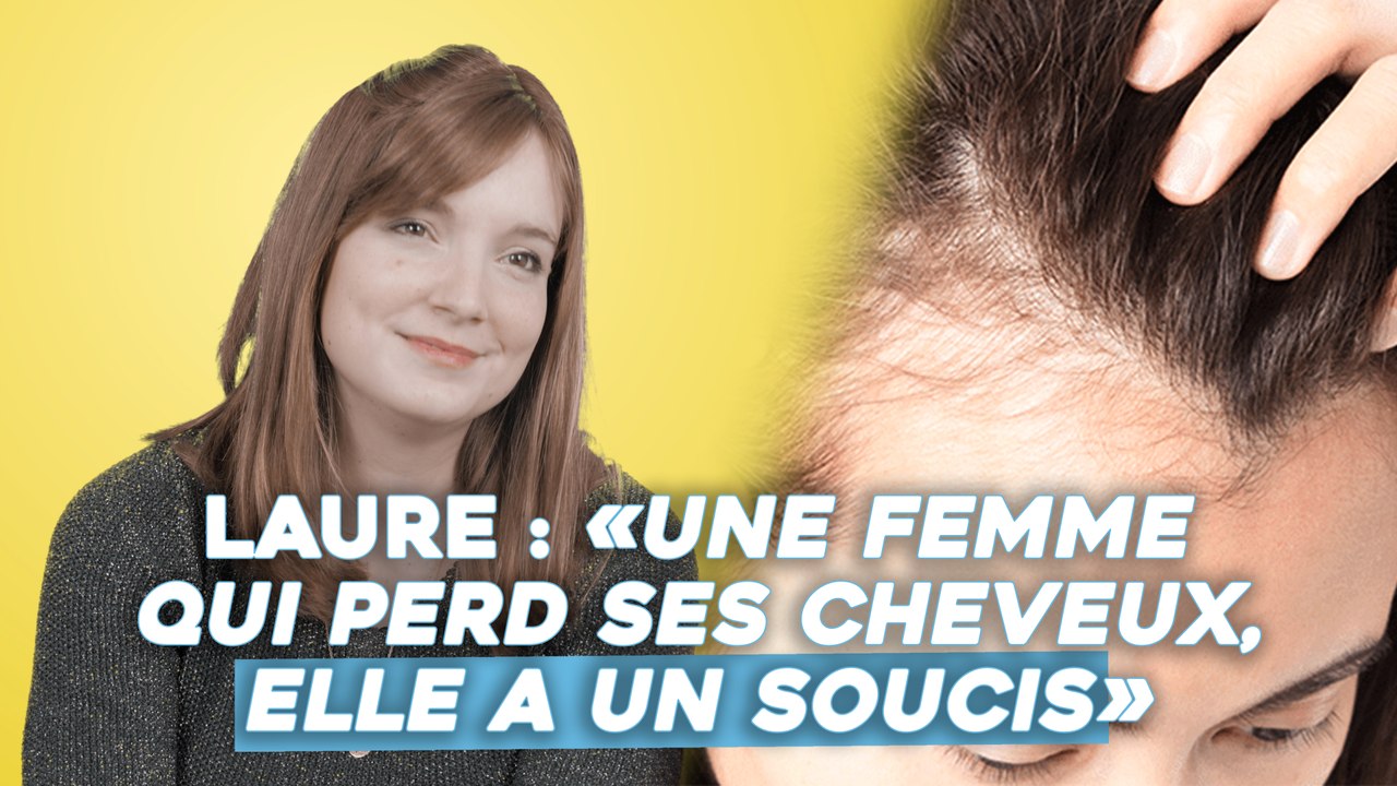 Atteinte d'alopécie androgénétique, Laure nous livre un témoignage poignant !