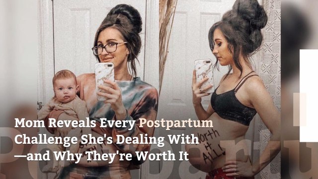 Mom Reveals Every Postpartum Challenge She's Dealing With (Even Hemorrhoids)—and Why They're Worth It