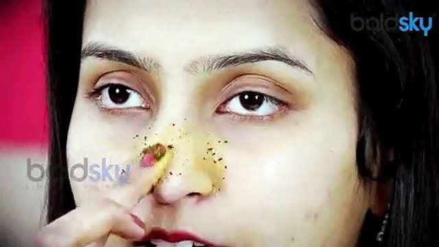 5 मिनट में Blackheads और Whiteheads गायब करें | Home Remedies to Remove Blackheads DIY | Boldsky