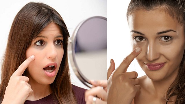 आंखों के काले घेरे और झुर्रियां जड़ से करें खत्म | Remove Dark Circles, Wrinkles under eyes |Boldsky
